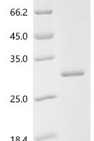 Bovine Prolactin (PRL) Recombinant Protein, C-10His - BioCrest Sci