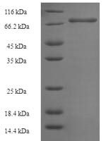 Human Notchless protein homolog 1 (NLE1) Recombinant Protein - BioCrest Sci