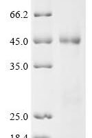 Human Pulmonary surfactant-associated protein A2 (SFTPA2), partial Recombinant Protein - BioCrest Sci