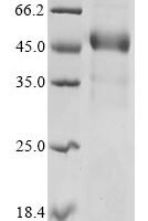 Human Disco-interacting protein 2 homolog C (DIP2C), partial Recombinant Protein, C-hFc1 - BioCrest Sci
