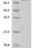 Human Mini-chromosome maintenance complex-binding protein (MCMBP) Recombinant Protein - BioCrest Sci