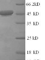 Rotavirus A Intermediate capsid protein VP6 Recombinant Protein, N-His - BioCrest Sci