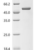 Mouse eIF5-mimic protein 2 (Bzw1) Recombinant Protein, C-His - BioCrest Sci