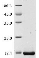 Human Protein IL-40 (C17orf99) Recombinant Protein, N-10His/C-Myc - BioCrest Sci
