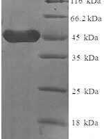 Human Low affinity immunoglobulin epsilon Fc receptor (FCER2), partial Recombinant Protein - BioCrest Sci