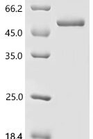 Human Eukaryotic translation initiation factor 4E (EIF4E) (S209D,I63A,I79A) Recombinant Protein, N-GST - BioCrest Sci