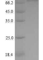 Human Kelch-like ECH-associated protein 1 (KEAP1) Recombinant Protein, N-His - BioCrest Sci