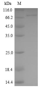 Human Kelch-like ECH-associated protein 1 (KEAP1) Recombinant Protein, N-His, Homo sapiens (Human), Yeast, N-terminal 6xHis-tagged, 71.7 kDa, purity >≥ 90% as determined by SDS-PAGE.