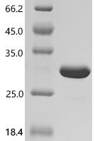 Klebsiella aerogenes Outer membrane protein A (ompA), partial Recombinant Protein - BioCrest Sci