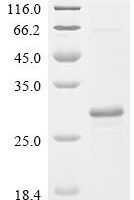 Bovine Beta-defensin 6 (DEFB6) Recombinant Protein, N-His-SUMO - BioCrest Sci