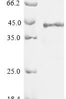 Human Regenerating islet-derived protein 3-gamma (REG3G) Recombinant Protein - BioCrest Sci