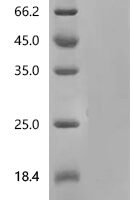 Human Chromogranin-A (CHGA) Recombinant Protein, C-10His, aa 19–457, Yeast - BioCrest Sci