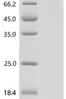Human Interleukin-17 receptor C (IL17RC), partial Recombinant Protein - BioCrest Sci