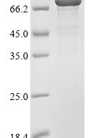 Bacteroides fragilis Biotin biosynthesis bifunctional protein BioAB (bioB) Recombinant Protein - BioCrest Sci
