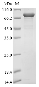 Bacteroides fragilis Biotin biosynthesis bifunctional protein BioAB (bioB) Recombinant Protein, Bacteroides fragilis (strain ATCC 25285 / DSM 2151 / CCUG 4856 / JCM 11019 / NCTC 9343 / Onslow), E.coli, N-terminal 10xHis-tagged and C-terminal Myc-tagged, 90.6 kDa, purity >≥ 85% as determined by SDS-PAGE.