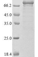 Human Alpha-1,3-mannosyl-glycoprotein 4-beta-N-acetylglucosaminyltransferase A (MGAT4A), partial Recombinant Protein, N-10His/C-Myc - BioCrest Sci