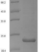 Woodchuck hepatitis B virus Protein X (X) Recombinant Protein, N-His, aa 1–141, E.coli - BioCrest Sci