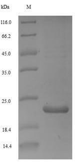 Woodchuck hepatitis B virus Protein X (X) Recombinant Protein, N-His, aa 1–141, E.coli, Woodchuck hepatitis B virus (isolate 8) (WHV), E.coli, N-terminal 6xHis-tagged, 19.2 kDa, purity >≥ 90% as determined by SDS-PAGE.