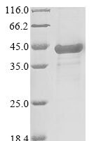 Rat Erythropoietin receptor (Epor), partial Recombinant Protein, N-His-SUMO/C-His - BioCrest Sci
