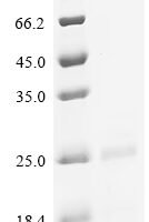 Pig Fibroblast growth factor (FGF2), partial Recombinant Protein - BioCrest Sci