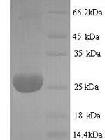 Bovine Adiponectin (ADIPOQ) Recombinant Protein, N-His - BioCrest Sci