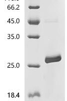 Mouse Neudesin (Nenf) Recombinant Protein, C-His, aa 31–171, E.coli - BioCrest Sci