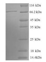Human Phosphoglycerate kinase 1 (PGK1), partial Recombinant Protein - BioCrest Sci
