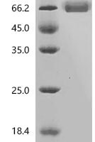 Human V-type immunoglobulin domain-containing suppressor of T-cell activation (VSIR), partial Recombinant Protein - BioCrest Sci