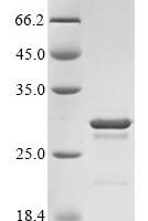 Human Ciliary neurotrophic factor (CNTF) Recombinant Protein, C-His - BioCrest Sci