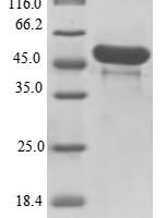 Clostridium botulinum C phage Main hemagglutinin component type C (HA-33) Recombinant Protein - BioCrest Sci
