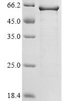 Adeno-associated virus Capsid protein VP3 (AAV2gp07) Recombinant Protein - BioCrest Sci
