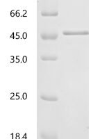 Saccharomyces cerevisiae General control protein GCN4 (GCN4) Recombinant Protein - BioCrest Sci