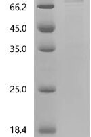 Human Pseudouridylate synthase PUS7L (PUS7L) Recombinant Protein, C-His, aa 1–701, E.coli - BioCrest Sci