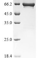 Human Serine/threonine-protein phosphatase 5 (PPP5C) Recombinant Protein - BioCrest Sci