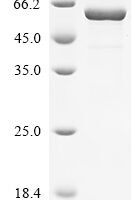 Human 7-alpha-hydroxycholest-4-en-3-one 12-alpha-hydroxylase (CYP8B1), partial Recombinant Protein - BioCrest Sci