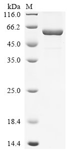 Human 7-alpha-hydroxycholest-4-en-3-one 12-alpha-hydroxylase (CYP8B1), partial Recombinant Protein, Homo sapiens (Human), E.coli, C-terminal 6xHis-tagged, 62.8 kDa, purity >≥ 85% as determined by SDS-PAGE.