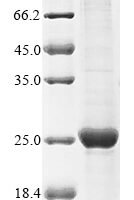 Human Hemoglobin subunit gamma-2 (HBG2) Recombinant Protein - BioCrest Sci