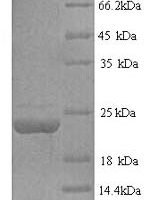 Human Tumor necrosis factor ligand superfamily member 6 (FASLG), partial Recombinant Protein, N-His - BioCrest Sci