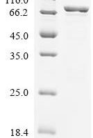 Escherichia coli Methionine--tRNA ligase (metG) Recombinant Protein - BioCrest Sci