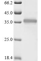 Rickettsia conorii Outer membrane protein A (ompA), partial Recombinant Protein, C-His - BioCrest Sci