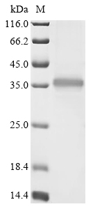 Rickettsia conorii Outer membrane protein A (ompA), partial Recombinant Protein, C-His, Rickettsia conorii (strain ATCC VR-613 / Malish 7), Baculovirus, C-terminal 6xHis-tagged, 37.4 kDa, purity >≥ 90% as determined by SDS-PAGE.