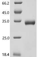 Mouse Filamin-C (Flnc), partial Recombinant Protein, C-10His - BioCrest Sci
