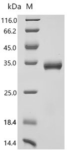 Mouse Filamin-C (Flnc), partial Recombinant Protein, C-10His, Mammalian cell, C-terminal 10xHis-tagged, 30.2 kDa, purity >≥ 90% as determined by SDS-PAGE.