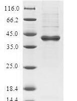Human Uncharacterized protein C19orf48 (C19orf48) Recombinant Protein - BioCrest Sci