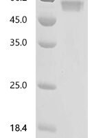 Human Tumor necrosis factor receptor superfamily member 6 (FAS), partial Recombinant Protein - BioCrest Sci