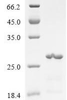 Human Osteopontin (SPP1), partial Recombinant Protein, N-10His - BioCrest Sci