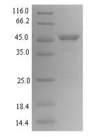 Helicobacter pylori Vacuolating cytotoxin autotransporter (vacA), partial Recombinant Protein, N-His-SUMO - BioCrest Sci