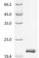 Staphylococcus aureus Small ribosomal subunit protein bS16 (rpsP) Recombinant Protein - BioCrest Sci