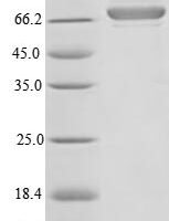 Human Plasma alpha-L-fucosidase (FUCA2), partial Recombinant Protein - BioCrest Sci