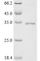 Human Williams-Beuren syndrome chromosomal region 27 protein (WBSCR27) Recombinant Protein - BioCrest Sci